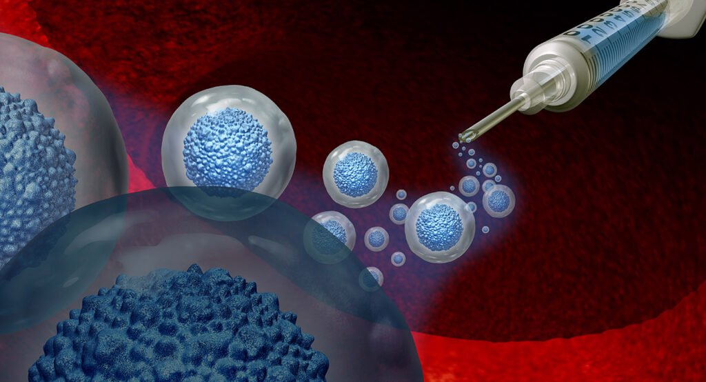 stem cell treatment